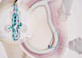 create 3d medical device animation, surgical procedure and orthopedic animation